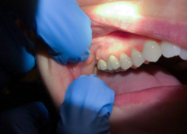 Best Pediatric Emergency Dentist in Merton, WI