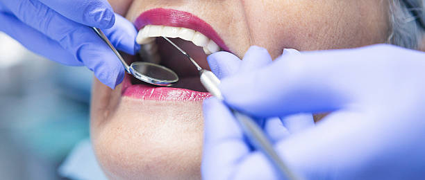 Best Emergency Gum Treatment in Merton, WI